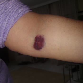 Görüntüleme Merkezinde Yaşanan Sorunlar Ve İlgisizlik