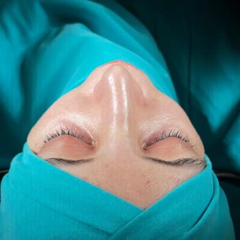 Estethica İle Ameliyat Pişmanlığı