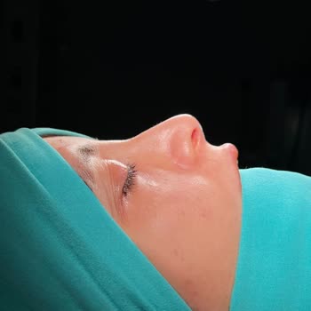 Estethica İle Ameliyat Pişmanlığı