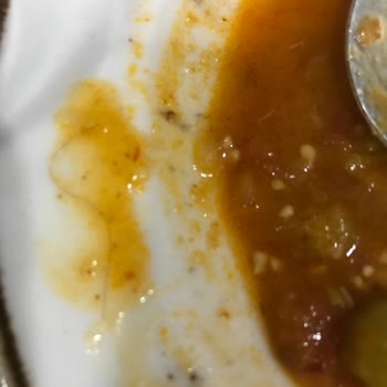 Ülker Superfresh Ürününde Hijyen Sorunu