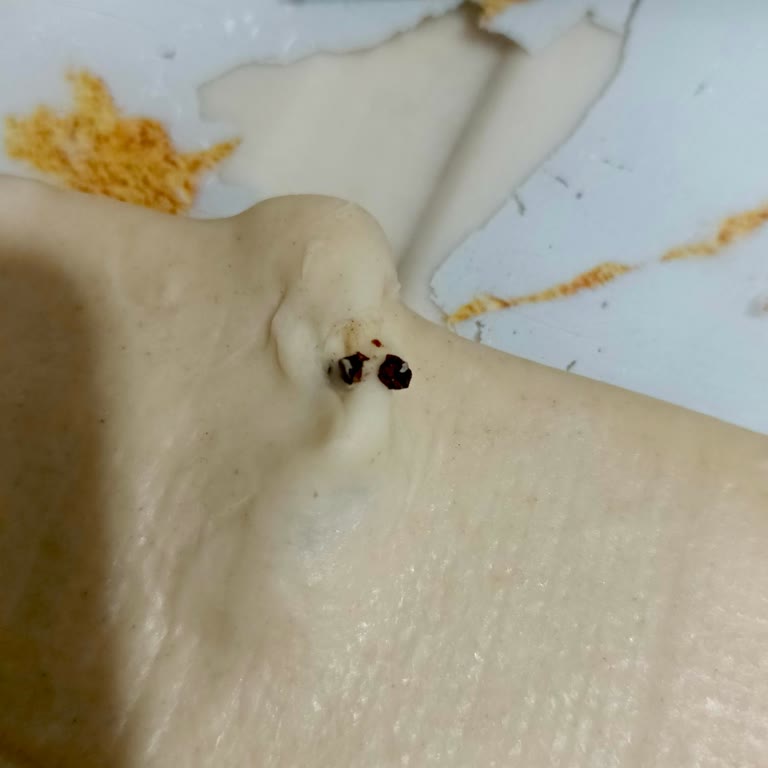 Milföyde İstenmeyen Sürpriz