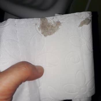 Solo Tuvalet Kağıdında Hijyen Sorunu: Kıllı Toz Yumağı Şoku