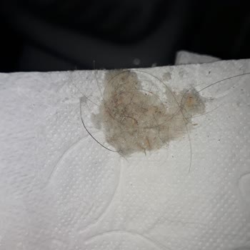 Solo Tuvalet Kağıdında Hijyen Sorunu: Kıllı Toz Yumağı Şoku