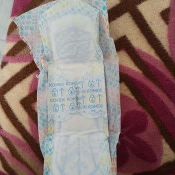 Kotex Kullanımı Sonrası Kaşıntı Ve Kızarıklık Sorunu