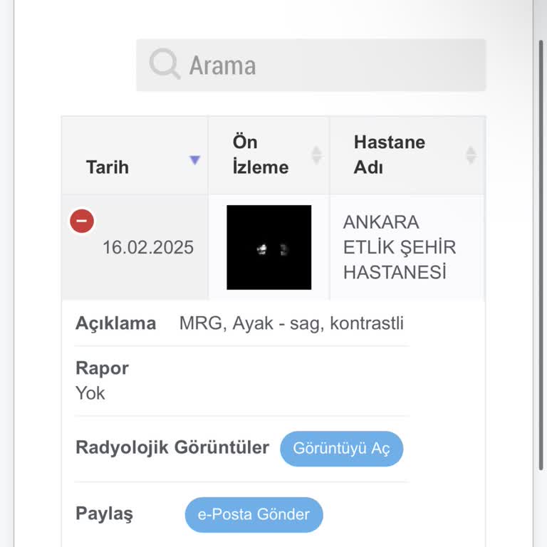 MR Sonuçlarının Gecikmesi Ve İlgisizlik