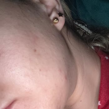 Cilt Ürünleri Hayal Kırıklığı