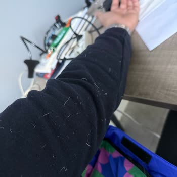 The North Face 1 Gün Bile Giymediğim Sıfır Montun Her Yerinden Kaz Tüyü Çıkıyor!