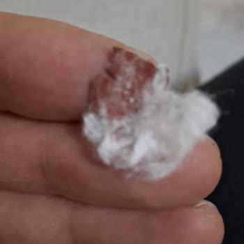 Bebek Temizleme Pamuğunda Beklenmedik Yabancı Maddeler