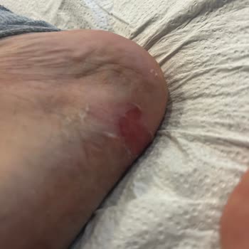 Guess Bot İlk Giyişte Ayaklarımı Yaraladı