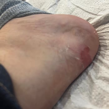 Guess Bot İlk Giyişte Ayaklarımı Yaraladı