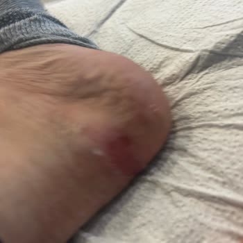 Guess Bot İlk Giyişte Ayaklarımı Yaraladı