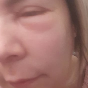 Loya Klinik Bakırköy Mağduriyeti