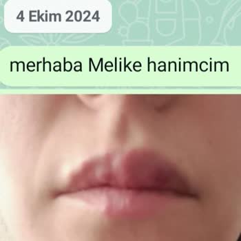 Kayseri Vogue Lux Güzellik Merkezinde Mağduriyet