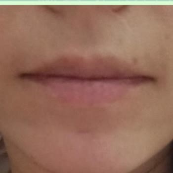 Kayseri Vogue Lux Güzellik Merkezinde Mağduriyet