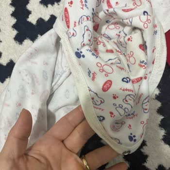 Molfix Bezlerde Taşma Sorunu