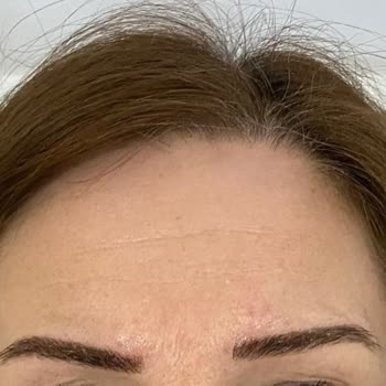 Microblading Kabusu: Deneyimsiz Ellerde Mahvolan Kaşlar
