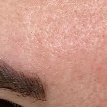 Microblading Kabusu: Deneyimsiz Ellerde Mahvolan Kaşlar
