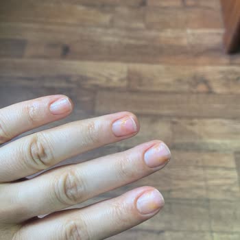 Kalıcı Oje Faciası: Sararmış Tırnaklar Ve İade Sorunu