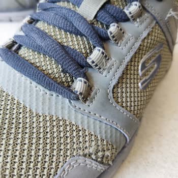 Skechers Ayakkabı Kalitesizliği Ve Müşteri Hizmetleri Hayal Kırıklığı