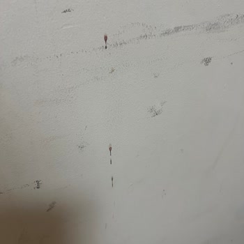 Acil Serviste Uzun Bekleyiş Ve Hijyen Sorunları