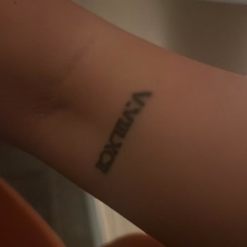 Dövme Sildirme İşlemi Hüsranla Sonuçlandı