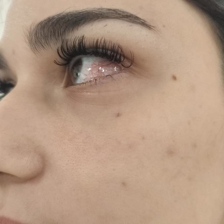 Ayşegül Mut Güzellik Merkezi İpek Kirpik Sonrası Gözde Batma Ve Kızarıklık Sorunu!
