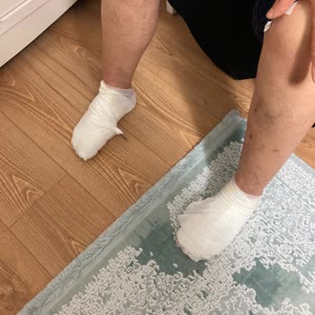 Homend Karaca Çaycı Patlaması: Müşteri Güvenliği Tehlikede