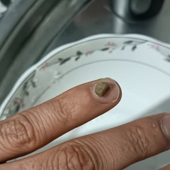 Dondurulmuş Kokoreçte Çıkan Taş Dişimi Mahvetti