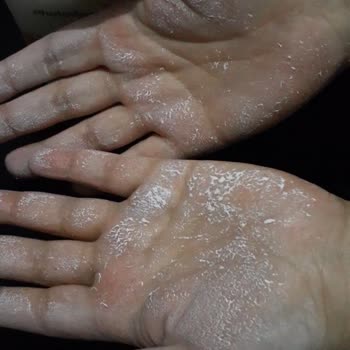 Bioderma Güneş Kremi Hayal Kırıklığı Yarattı