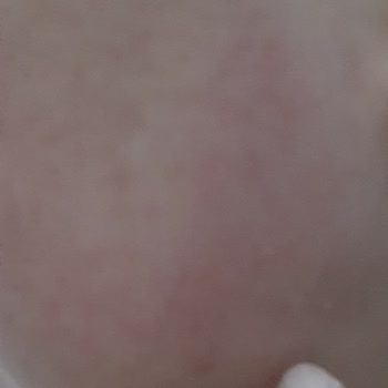 Bioderma Güneş Kremi Hayal Kırıklığı Yarattı
