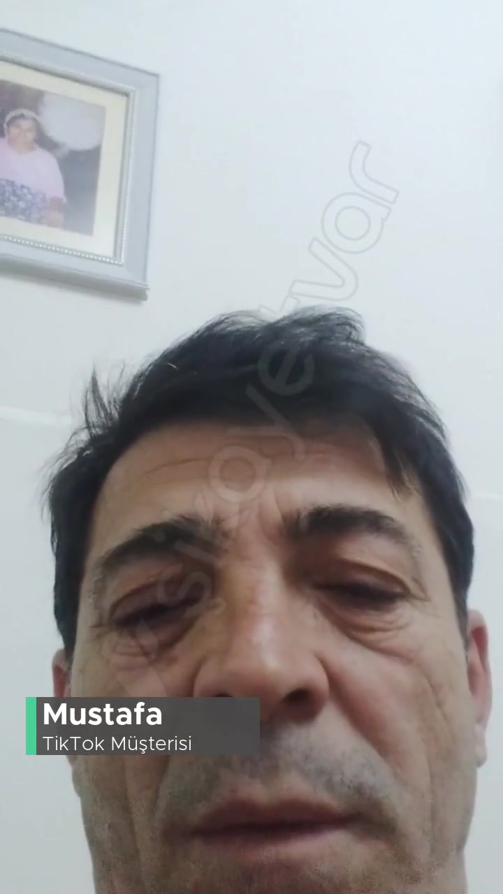 TikTok Ses Sorunu Yaşıyorum Silip Tekrar Yüklediğim Halde videonun kapak resmi