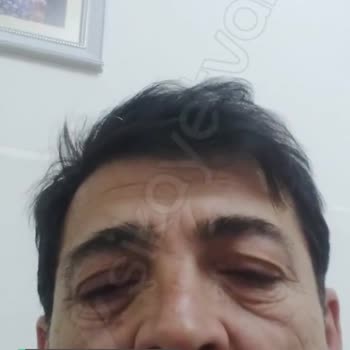 TikTok Ses Sorunu Yaşıyorum Silip Tekrar Yüklediğim Halde
