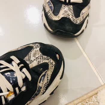 Skechers Ayakkabıda Yırtılma Ve Yetersiz Müşteri Hizmeti