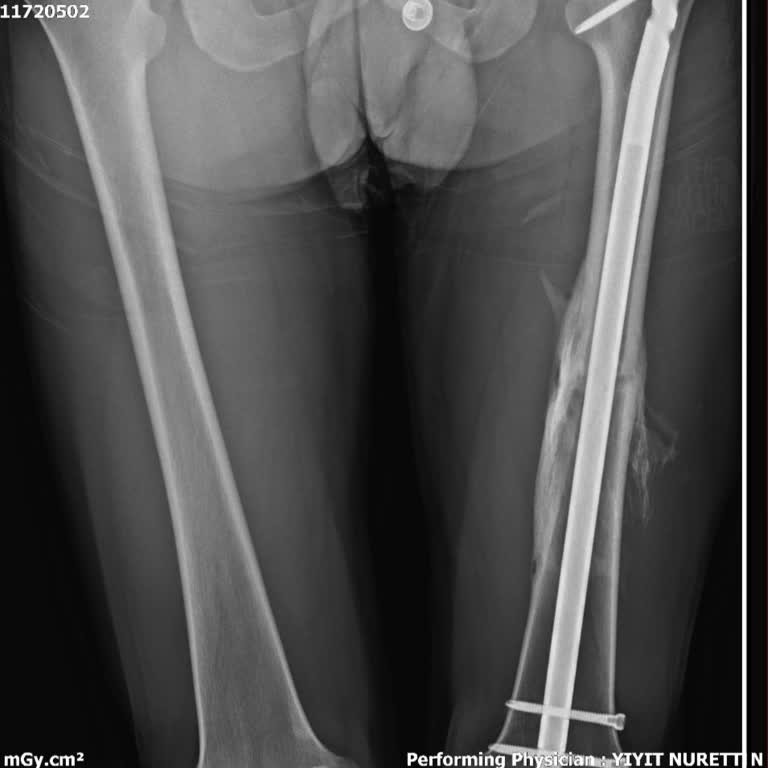 Sigorta Sürecinde Bitmeyen Mağduriyet
