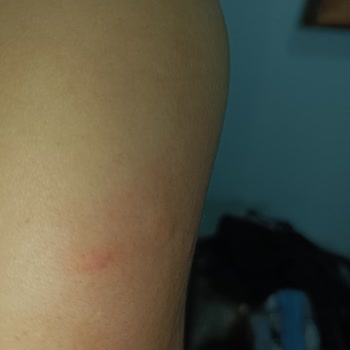 Tahta Kurusu Tatilimizi Kabusa Çevirdi