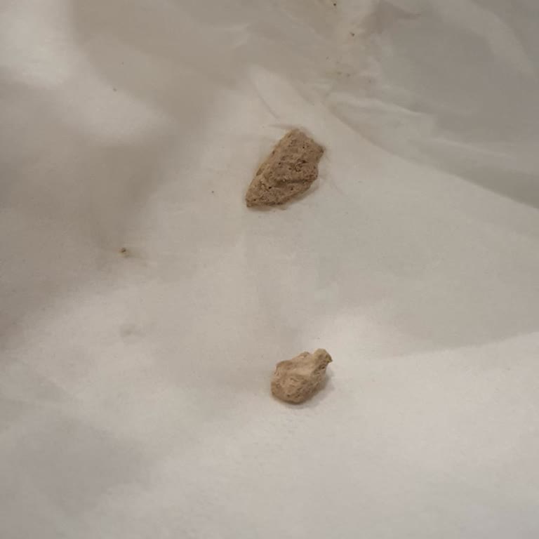 Saray Köfte Balık Restaurant Salatanın İçinden Taş Çıktı