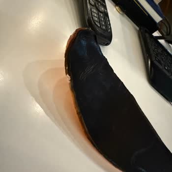 Ayakkabının Deformasyonu Ve Müşteri Hizmetleri İlgisizliği