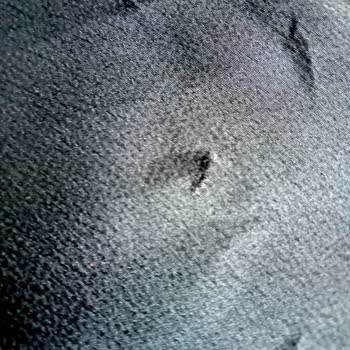 Aldığım Elbise Yırtık Ve Eksik Parçalarla Geldi