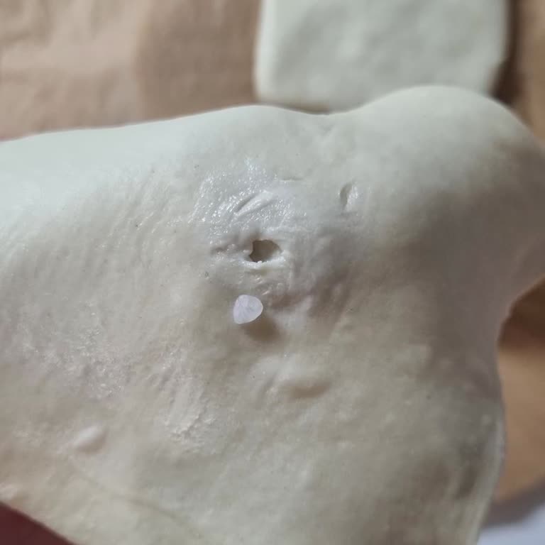 Milföy İçinde Beklenmedik Madde