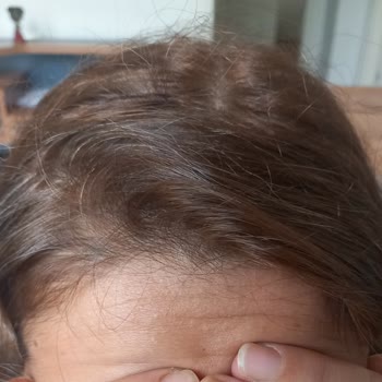 Boya Uygulaması Sonrası Hayal Kırıklığı