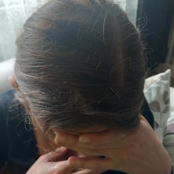 Boya Uygulaması Sonrası Hayal Kırıklığı