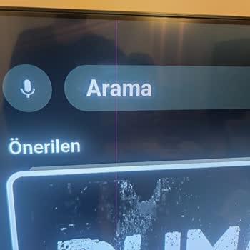 Samsung TV'de Erken Piksel Yanığı Ve Değişim Talebinin Reddedilmesi