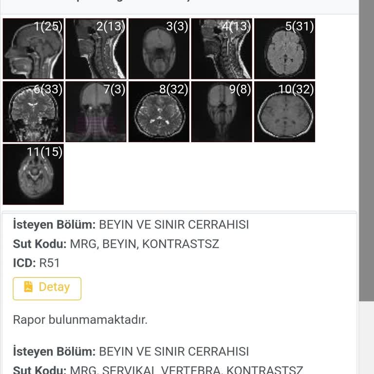 MR Raporu Bekleme Süresi Mağduriyeti