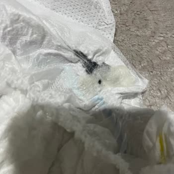 Molfix Bebek Bezinde Sakız Şoku!