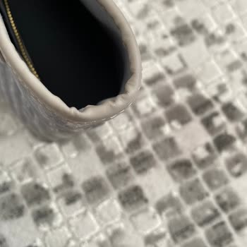 Çantamın Hızla Soyulması Ve Yetersiz Müşteri Hizmeti