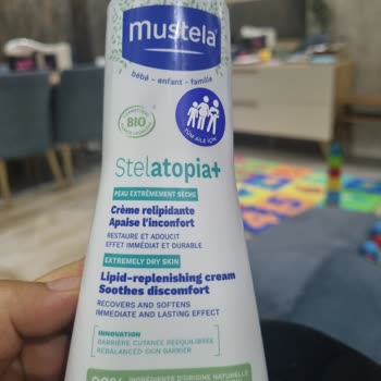 Mustela Stelatopia: Çocuğumuzda Kırmızı Benekler