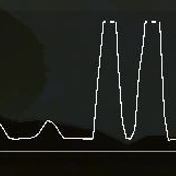 TurkNet Müşteri Hizmetleri Ve İnternet Bağlantı Sorunları