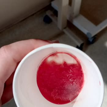 Hastanede İhmalkarlık Ve İletişim Sorunları