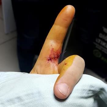 Acil Durumda Yetersiz Hizmet Ve Ücret Şoku