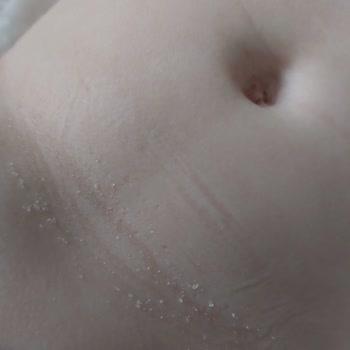 Sleepy Bebek Bezlerinde Emici Tanecik Sorunu Ve İlgisiz Müşteri Hizmeti